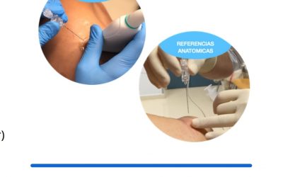 Curso Online: Vídeo Formación en «TÉCNICAS BÁSICAS DE INFILTRACIÓN EN APARATO LOCOMOTOR»