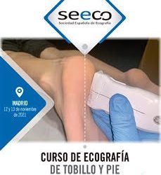 Curso de Ecografía de Tobillo y Pie – II JORNADA DE ECO-PODOLOGÍA