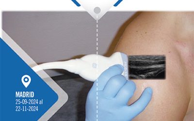 II Curso Híbrido de Ecografía Musculoesquelética. Lesiones de Hombro