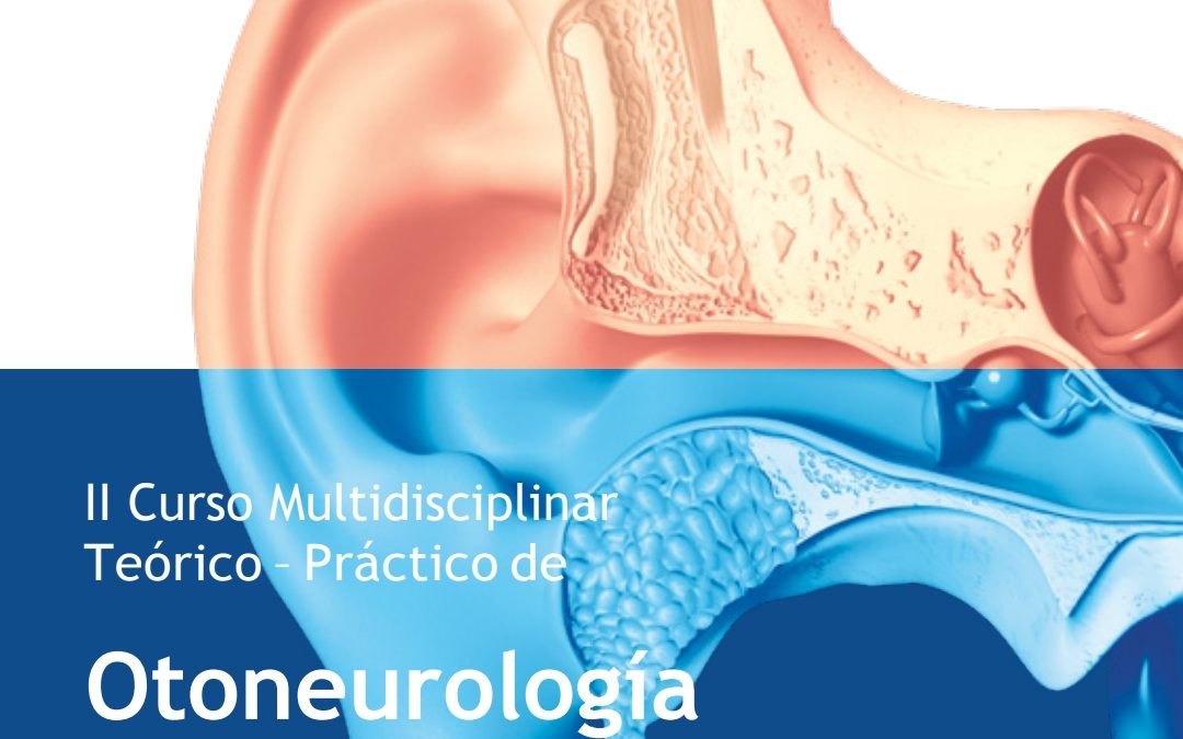 II Curso Multidisciplinar Teórico-Práctico de Otoneurología y Rehabilitación vestibular