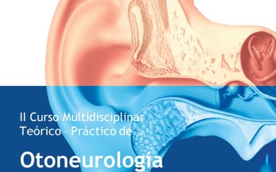 II Curso Multidisciplinar Teórico-Práctico de Otoneurología y Rehabilitación vestibular