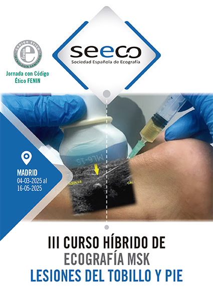 III Curso Híbrido de Ecografía MSK Lesiones de Tobillo y Pie, organizado por S.E.ECO