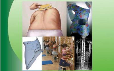 V CURSO MONOGRÁFICO INTERDISCIPLINAR DE LA ESCOLIOSIS. Desde la sospecha a la cirugía.